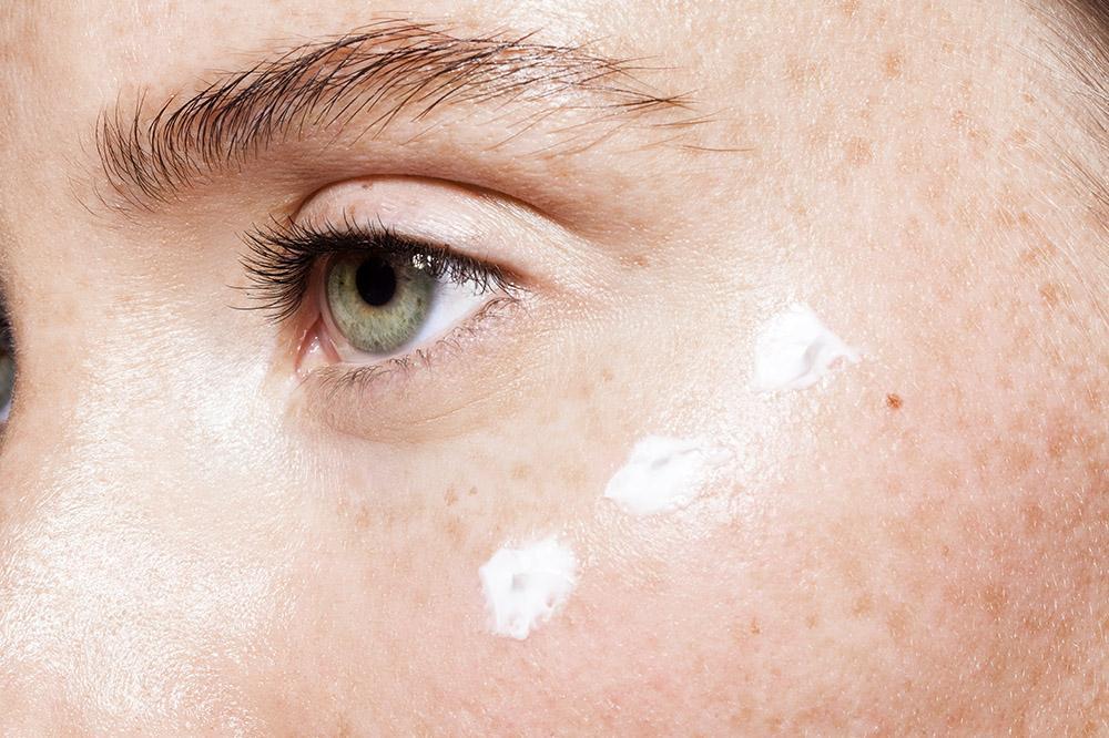 Dark Circles and Eye Bags - Why they occur and Holistic remedies
