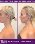 First Time Facial Gift Certificate - $190 (Use For The Facial Of Your Choice!)