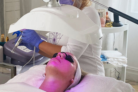 Facial Deepdive: The Purple Ray Facial For Acne and Youthful Eyes