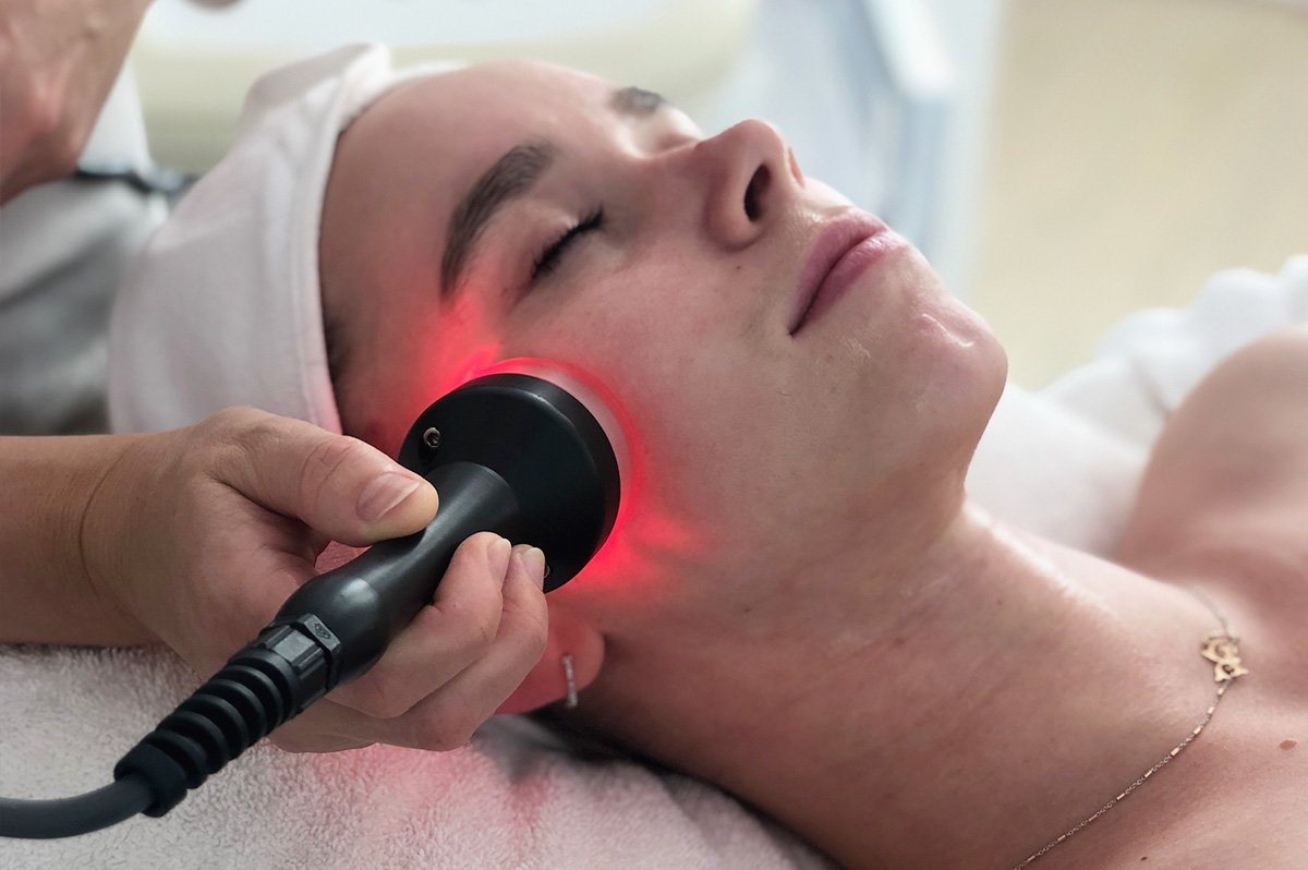 Why Our Radiofrequency Facial is a Must For Younger-Looking Skin