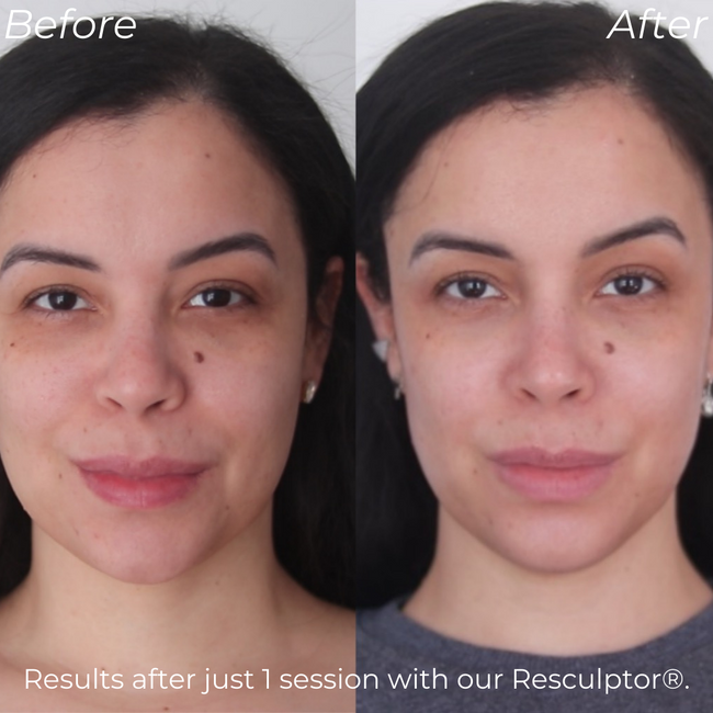 First Time Facial Gift Certificate - $170 (Use For The Facial Of Your Choice!)