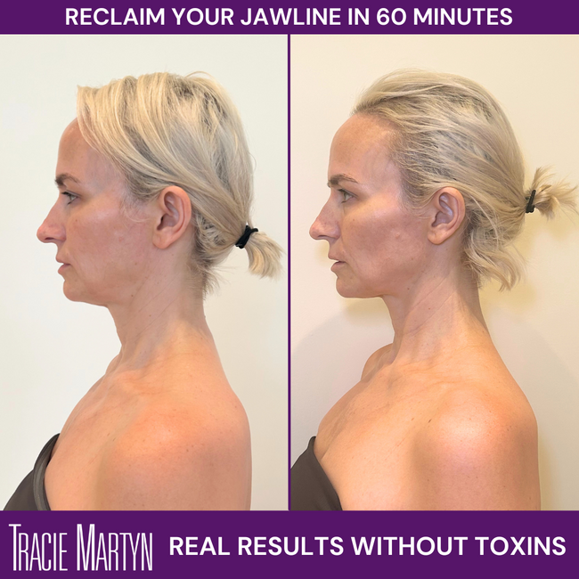 First Time Facial Gift Certificate - $170 (Use For The Facial Of Your Choice!)
