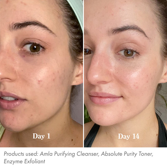 Skincare Reset